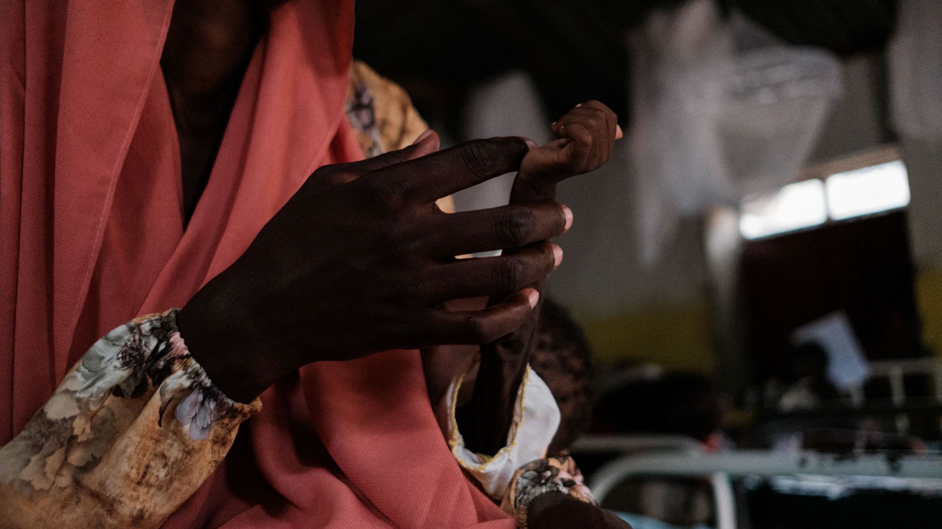 A mother holds the severely malnourished arm of her one-year-old in a hospital in Sudan.