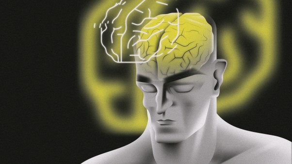 A man with a yellow brain